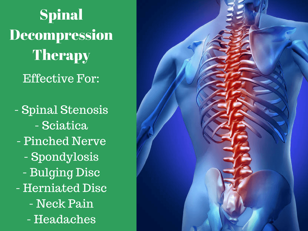 spinal decompression treatments